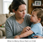 When to Worry About Rash on Child